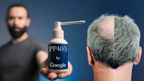 The Beginner’s Guide to PP405 Hair Loss Supplements