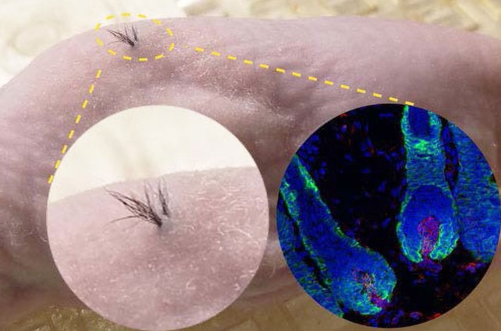 Can Stemson Therapeutics Really End Hair Loss? The Truth Behind the New Hope