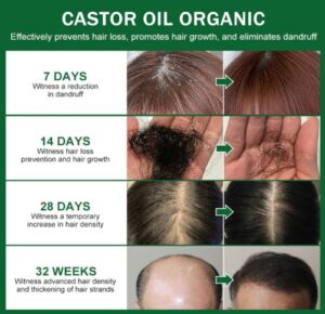 Will castor oil grow hair