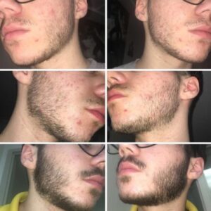 beard and mustache grooming kits